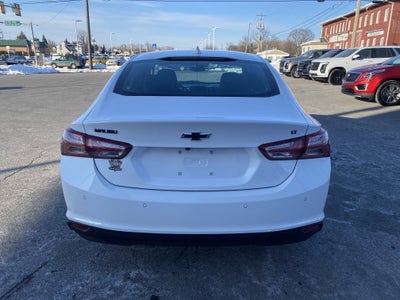 2025 Chevrolet Malibu 1LT